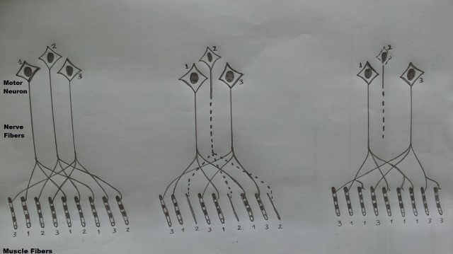Gambar-1.-Inervasi-dan-denervasi-pada-serat-otot.-Disalin-dari-Fig.-2.2-buku-Mitsumoto-2009.jpg