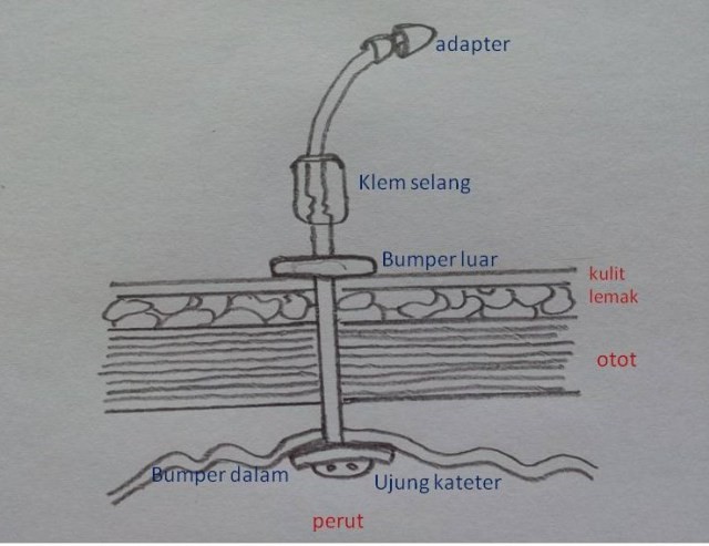 Gambar-5.-PEG.-Disalin-dari-McCarthy-et-al-2012..jpg