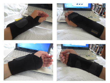 Gambar-2.-Penahan-pergelangan-tangan-wrist-brace.-Yang-kiri-tanpa-splint-yang-kanan-dengan-splint-metal..png